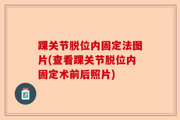 踝关节脱位内固定法图片(查看踝关节脱位内固定术前后照片) 踝关节脱位内固定法图片(查看踝关节脱位内固定术前后照片)